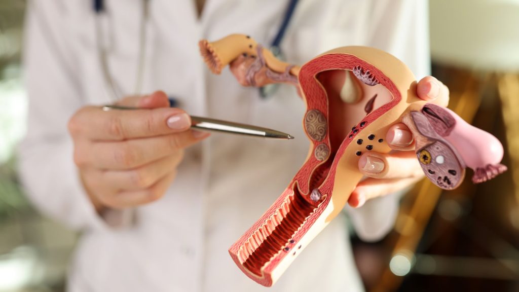 médica mostrando aparelho íntimo feminino
